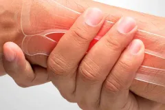 Osteoporosis: la enfermedad silenciosa que debilita los huesos y pone en riesgo la movilidad